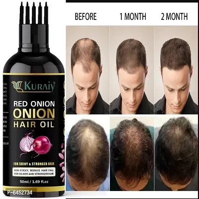 Onion Black Seed oil For Hair Fall Control, Hair Growth and Hair Regrowth-Control Dandruff-thumb0