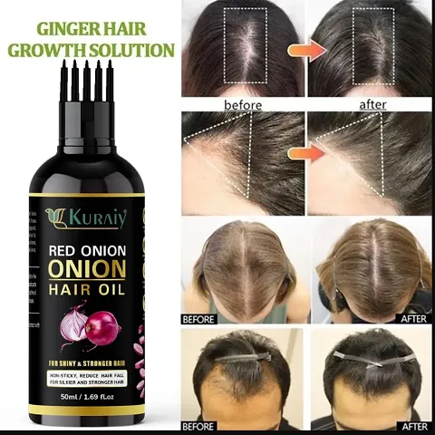 Most Trusted Hair Oil For Hair Growth