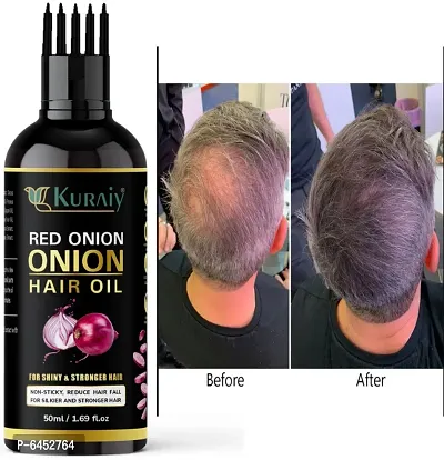 Pure and Natural Onion Hair Oil Pack 1-thumb0