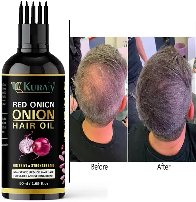 Most Trusted Hair Oil For Hair Growth