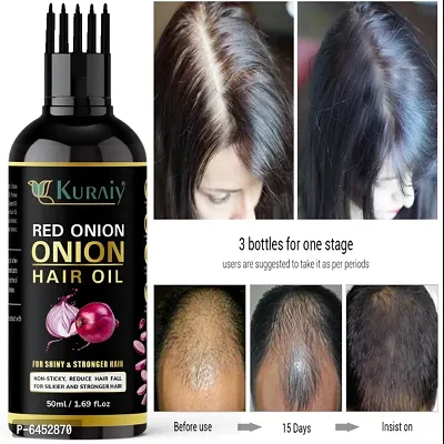 ONION OIL ANTI HAIR LOSS and HAIR GROWTH OIL WITH PURE ARGAN, JOJOBA, ROSEMARY, BLACK SEED OIL IN PUREST FORM VERY EFFECTIVELY CONTROL HAIR LOSS, PROMOTES HAIR GROWTH