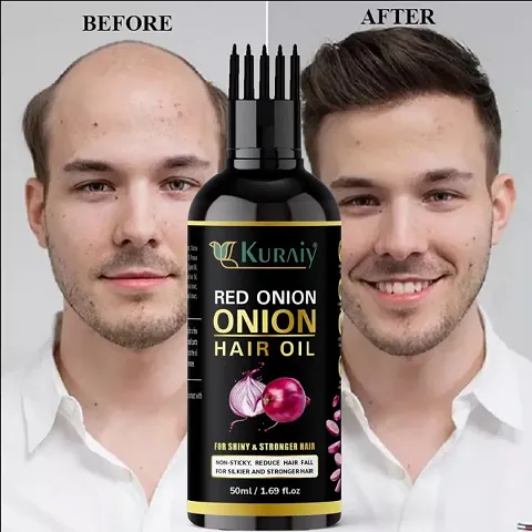 Onion Hair Oil For Strong Beautiful Hair