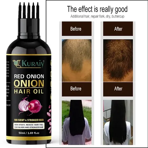 Onion Hair Oil For Strong Beautiful Hair