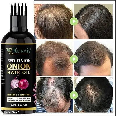 Onion Hair Oil with 14 Essential Oils, Onion Hair Oil For Hair Growth