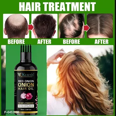 Onion Hair Oil For Hair Growth and Anti Dandruff Oil-thumb0