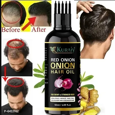 Onion Garlic oil 14 Herbs Perfectly Blended For Hair Growth and Anti-Hair Fall Hair Oil-thumb0