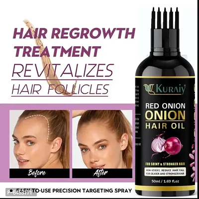 Onion Oil for Hair Regrowth and Hair Fall Control Hair Oil-thumb0