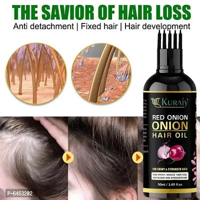 Ayurvedic Onion with black seed Oil for Controls Hair Fall Hair Oil 50ml