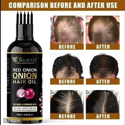 Onion Ginger Oil Help For Rapid Hair Growth,Anti Hair Fall,Split Hair And Promotes Softer and shinier Hair 50ML