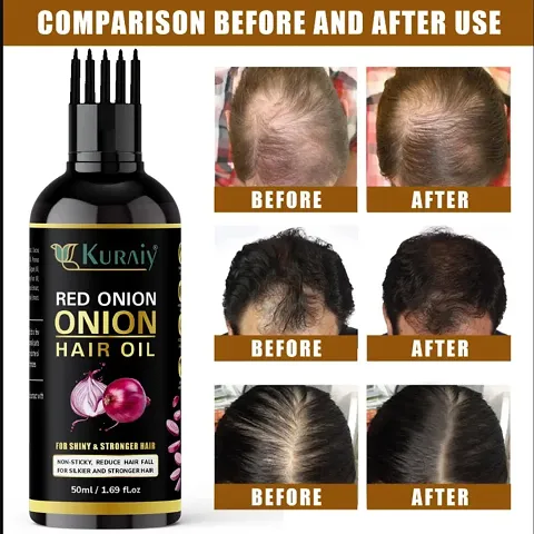 Natural Onion Herbal Oil For Hair Growth