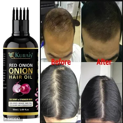 Red Organic Onion Hair Oil for Hair Fall Control-thumb0