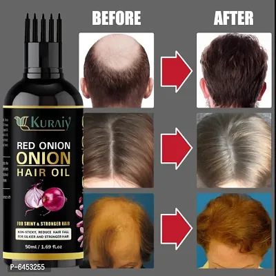Onion Hair Oil with 14 Essential Oils, Onion Hair Oil For Hair Growth
