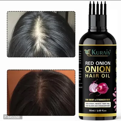 Onion Black Seed oil For Hair Fall Control, Hair Growth and Hair Regrowth-Control Dandruff (50ML)