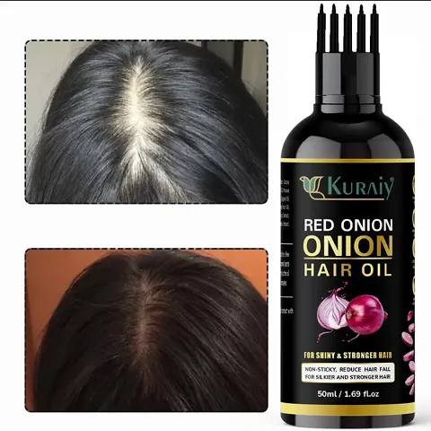 Most Trusted Hair Oil For Hair Growth