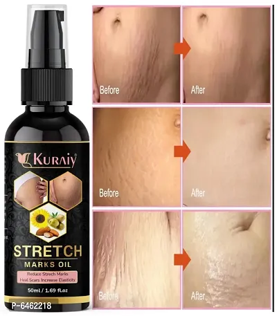 Kuraiy present Repair Stretch Marks Removal - Natural Heal Pregnancy Breast, Hip, Legs, Mark oil 50 ml pack of 1-thumb0