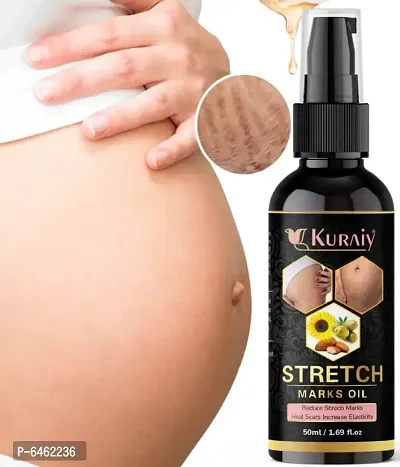 Kuraiy present Repair Stretch Marks Removal - Natural Heal Pregnancy Breast, Hip, Legs, Mark oil 50 ml pack of 1-thumb0