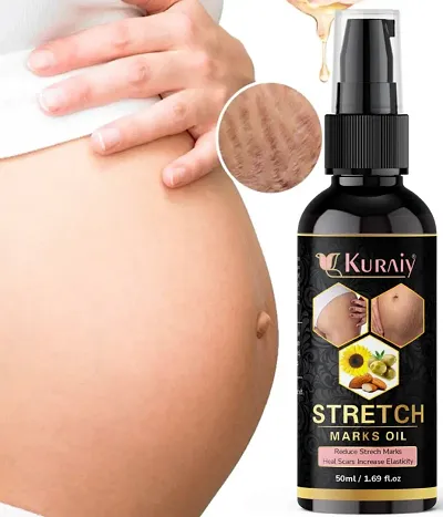 Best Selling Stretch Marks Removal Oil