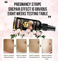 Kuraiy present Repair Stretch Marks Removal - Natural Heal Pregnancy Breast, Hip, Legs, Mark oil 50 ml pack of 1-thumb1