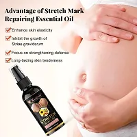 Kuraiy present Repair Stretch Marks Removal - Natural Heal Pregnancy Breast, Hip, Legs, Mark oil 50 ml pack of 1-thumb3