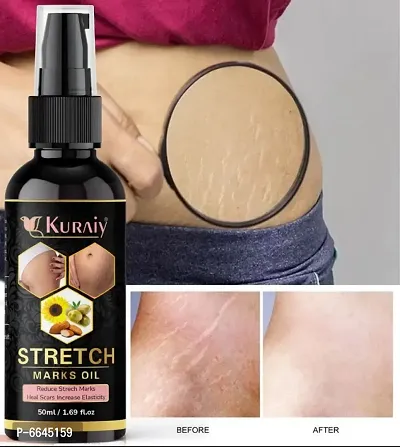 Kuraiy stretch Oil for Stretch Marks Removal Post Pregnancy fast work 100% result stretch mark cream oil  (50 ml)-thumb0