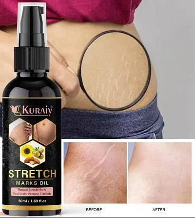 Kuraiy stretch Oil for Stretch Marks Removal