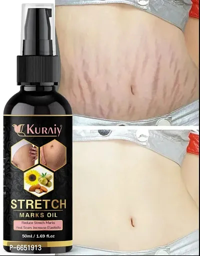 Kuraiy stretch Oil for Stretch Marks Removal Post Pregnancy fast work 100% result stretch mark cream oil  (50 ml)