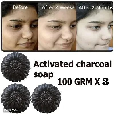 Kuraiy Activated Charcoal Deep Cleansing Bath Soap, 100g (Pack of 3)  (3 x 100 g)