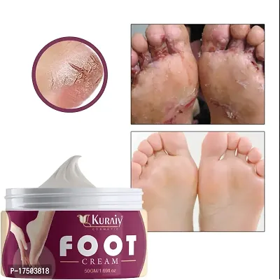 KURAIY Foot Crack Cream For Dry Cracked Heels  Feet Foot Cream (50gm)-thumb0