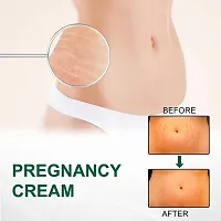 KURAIY Remove Pregnancy Mark Body Cream Treatment Scars Acne Stretch Marks Cream Maternity Repair-thumb3