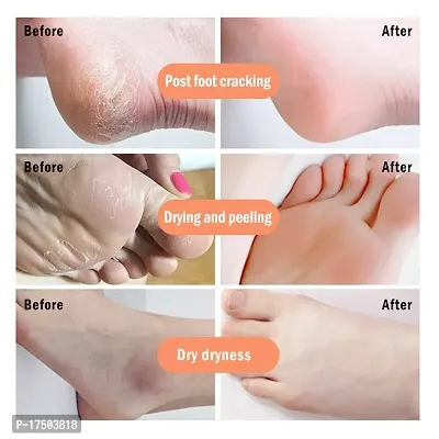 KURAIY Foot Crack Cream For Dry Cracked Heels  Feet Foot Cream (50gm)-thumb3
