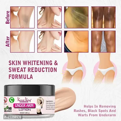 KORAT KING  Underarm Whitening Cream For Remove Black Spots  Warts (50 GM)-thumb2