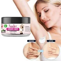 KORAT KING Underarm Whitening Cream For Remove Black Spots  Warts (50 GM)-thumb1