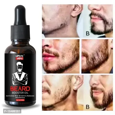 urban men Advanced  Beard Hair Growth oil- best beard oil for mens,beard growth oil,patchy beard growth,dadhi oil,mooch oil,dadhi ugane wala oil,advanced beard growth oil,orignal beard oil,bear