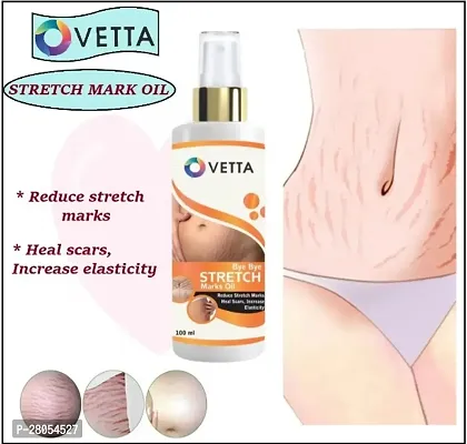 Ovetta Stretch mark removal oil men and women 100 ml (PACK OF-1)