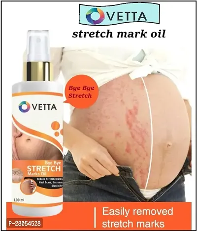 Ovetta Stretch mark removal oil men and women 100 ml (PACK OF-1)-thumb0