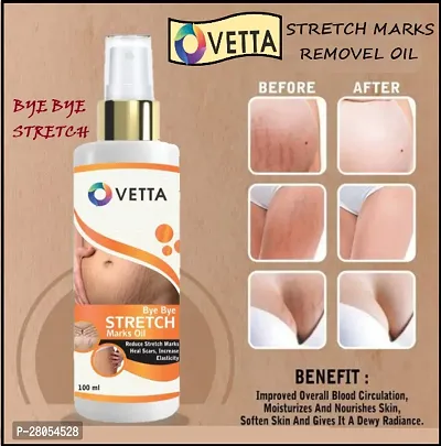 Ovetta Stretch mark removal oil men and women 100 ml (PACK OF-1)-thumb3