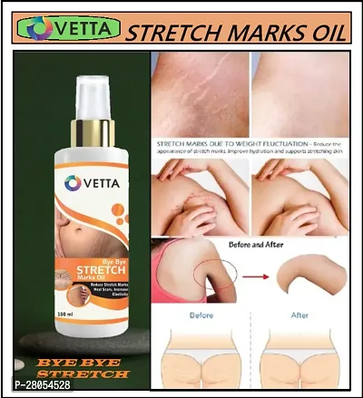 Ovetta Stretch mark removal oil men and women 100 ml (PACK OF-1)-thumb2