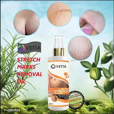 Ovetta Stretch mark removal oil men and women 100 ml (PACK OF-1)-thumb4