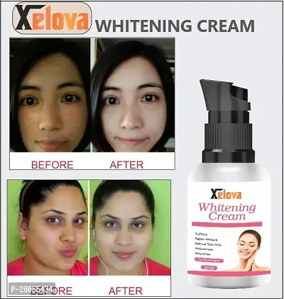 Xelova Whitening Cream 30 Ml Pack Of-1