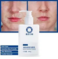 Freckle Removal Cleanser-thumb1