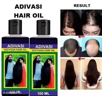 Adivasi Herbal Hair Oil For Hair Growth And Hair Fall Control Pack Of 2 (200 Ml)