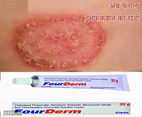 Four Derm  Ayurvedic Product Harbal Ayurvedic Product, , Pharmacy Medicine,Skin Disease,Dad, Dinay,Apras,Eczema,Dad Khaj Khujli Ki Dava,Charm Rog.(pack of 2)-thumb2