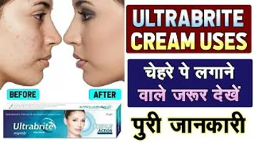 2 Pes Ultrabrite Fairness Cream , Broadspectrum, UVA/UVB Protection, For All Skin Types Sun Screen Root Fruit Face Cream, for Anti Ageing, Dark Spot Removal, Skin Whitening  Brightening, Acne  Scars-thumb2