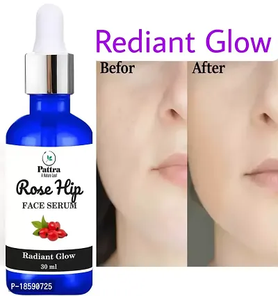 Pattra Rose Hip Face Serum For Radiant Glow And Makes Skin Glossy (30 Ml)