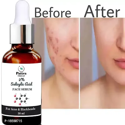 Pattra Salicylic Acid Face Serum For Acne Mark,Dark Spot (30 Ml)