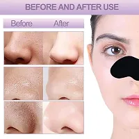 Useful Nose Strips Blackhead Remover Cleanser Strips, 10 Pc's-thumb2