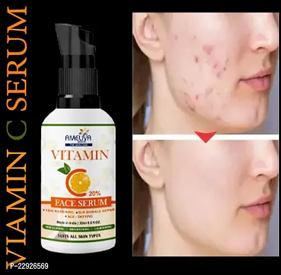 Vitamin C Face Serum for Skin Whitening, Glowing Skin,Dark Spots, Brightening Anti Aging Skin Repair Serum-thumb0