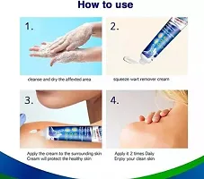 Wart Removal Ointment, Skin Tag Removal Cream, Massa Remover Cream, Anti-WART Cream ,Blackhead Remover Cream ,Massa Nashak Cream for Remove Warts  Callosities , Safely, Painlessly Skin For Women  Me-thumb2