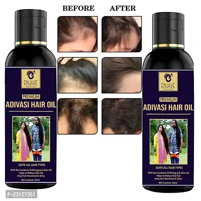 Enjave adivasi harbal Hair Oil For Hair Fall treatment | oil l Red Onion Hair Oil l Onion Hair Oil l Onion Hair Oil l Hair Oil l Sesame Hair Oil Pack Of 2-thumb0