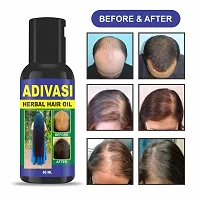 Classic Adivasi Herbal Hair Oil For All Type Of Hair Problem Growth Hair Oil 60 Ml,Pack Of 1-thumb2